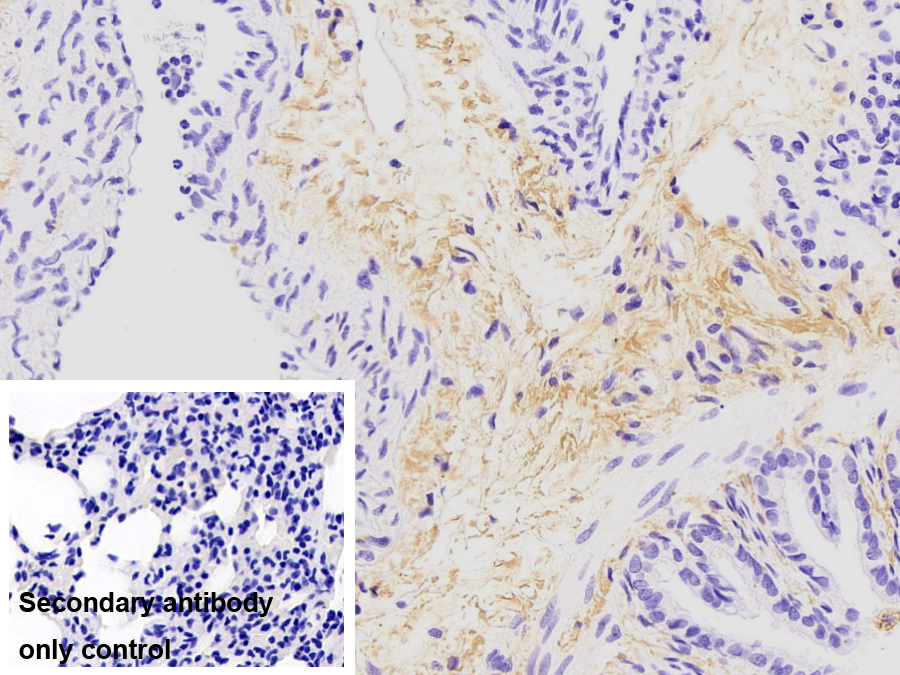 Monoclonal Antibody to Collagen Type I Alpha 1 (COL1a1)