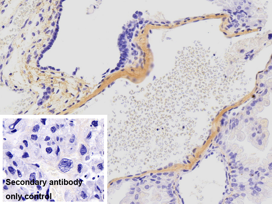 Monoclonal Antibody to Collagen Type I Alpha 1 (COL1a1)