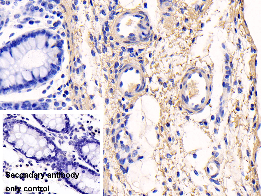 Monoclonal Antibody to Collagen Type I Alpha 1 (COL1a1)