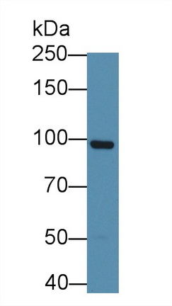 Monoclonal Antibody to Gelsolin (GSN)