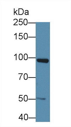 Monoclonal Antibody to Gelsolin (GSN)