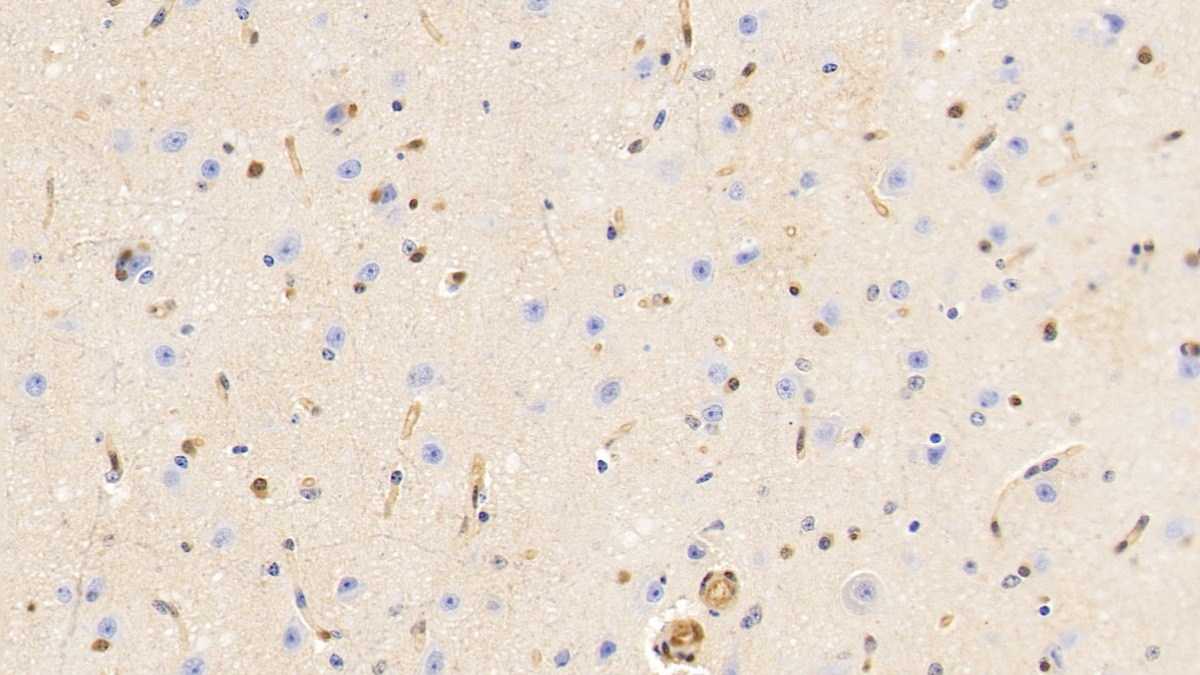 Monoclonal Antibody to Gelsolin (GSN)