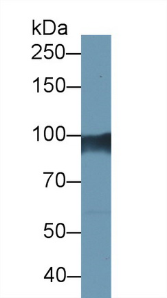 Monoclonal Antibody to Gelsolin (GSN)