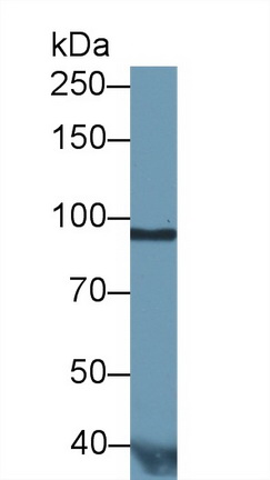 Monoclonal Antibody to Gelsolin (GSN)