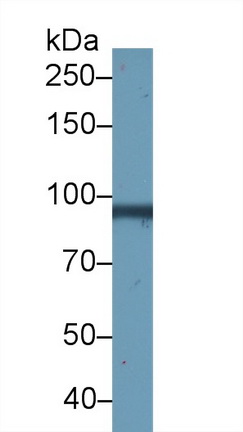 Monoclonal Antibody to Gelsolin (GSN)