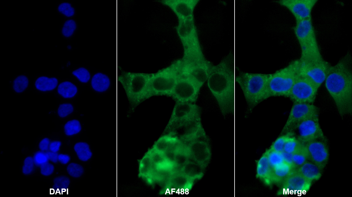 Monoclonal Antibody to Desmin (Des)
