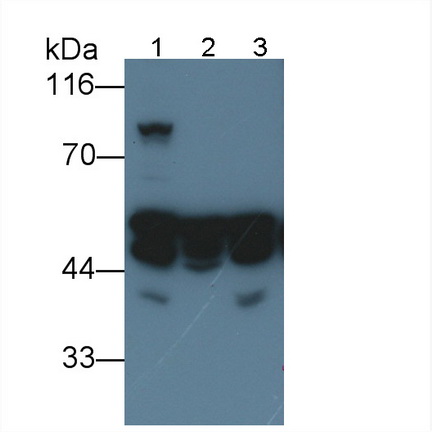 Monoclonal Antibody to Desmin (Des)