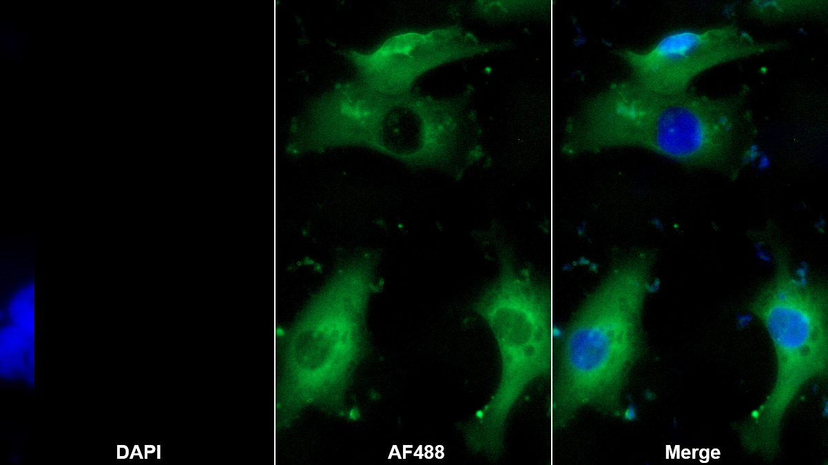 Monoclonal Antibody to Desmin (Des)
