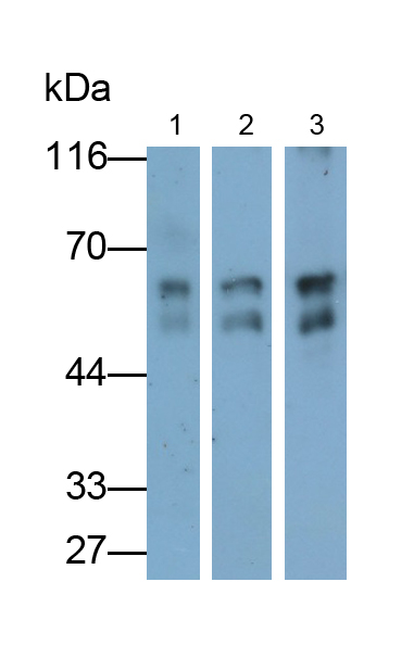 Monoclonal Antibody to Desmin (Des)