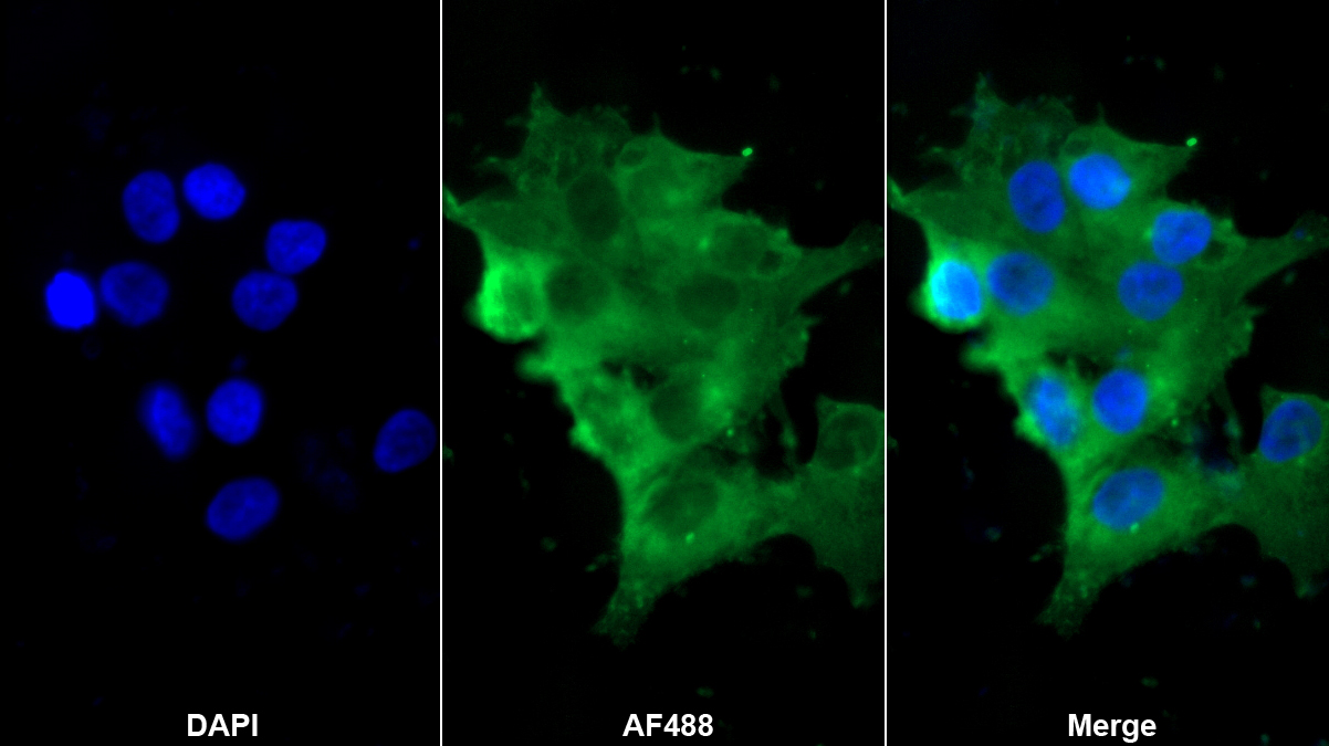 Monoclonal Antibody to Desmin (Des)