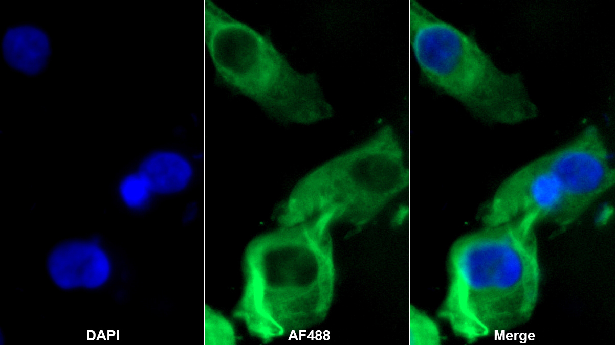Monoclonal Antibody to Desmin (Des)