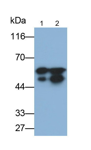 Monoclonal Antibody to Desmin (Des)