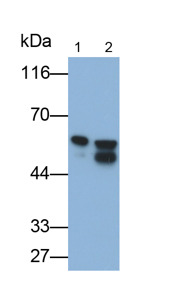 Monoclonal Antibody to Desmin (Des)
