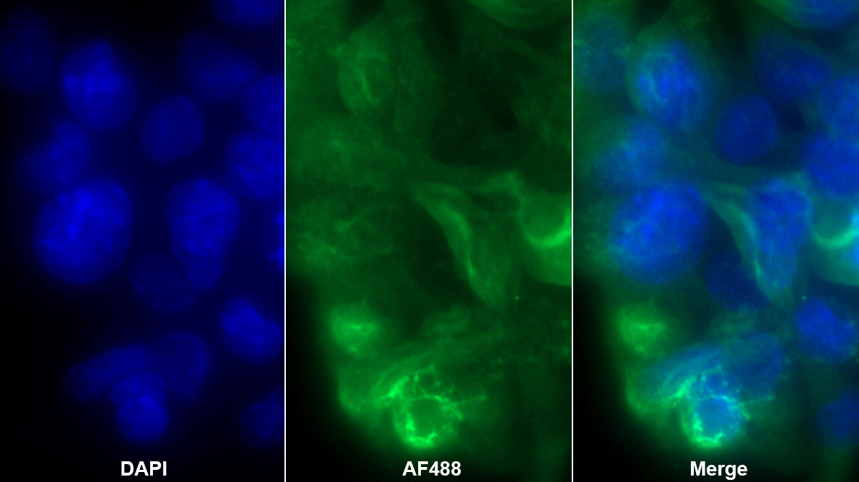 Monoclonal Antibody to Actinin Alpha 2 (ACTN2)