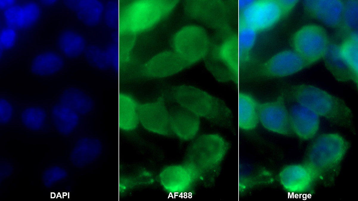 Monoclonal Antibody to Actinin Alpha 2 (ACTN2)