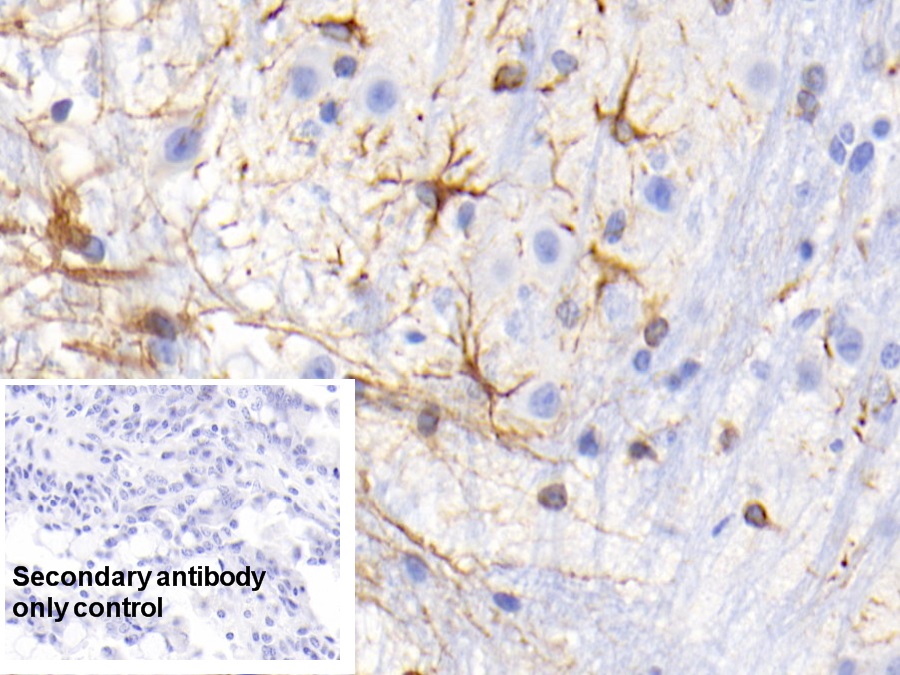 Monoclonal Antibody to Retinol Binding Protein 2, Cellular (RBP2)