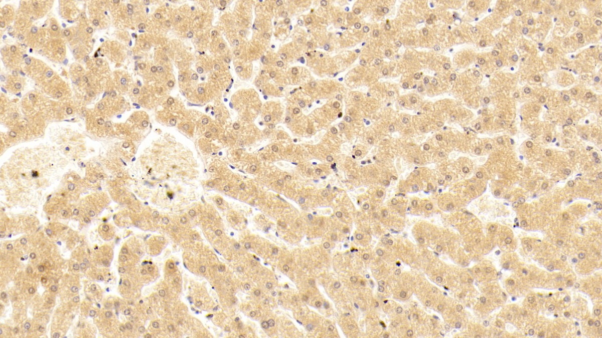 Monoclonal Antibody to Complement Component 5a (C5a)