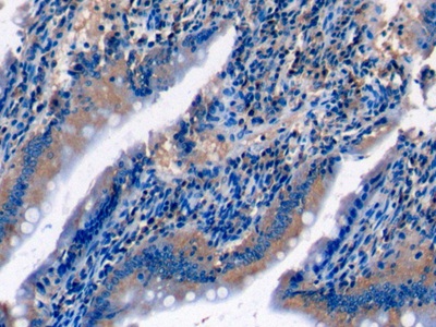 Monoclonal Antibody to Complement Component 5a (C5a)