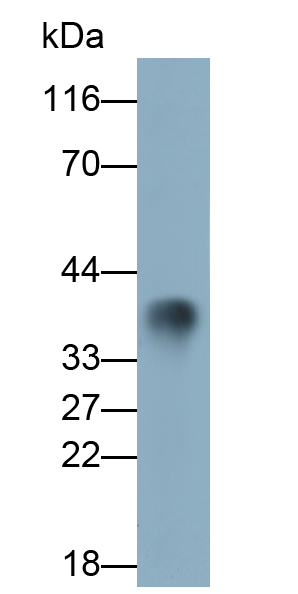 Monoclonal Antibody to Tissue Factor Pathway Inhibitor (TFPI)