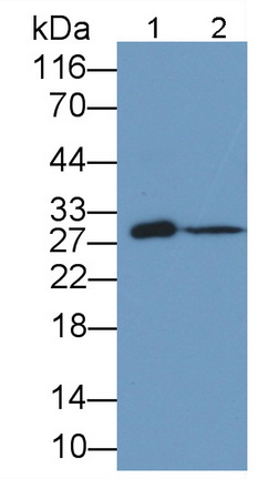 Monoclonal Antibody to Tissue Factor Pathway Inhibitor (TFPI)