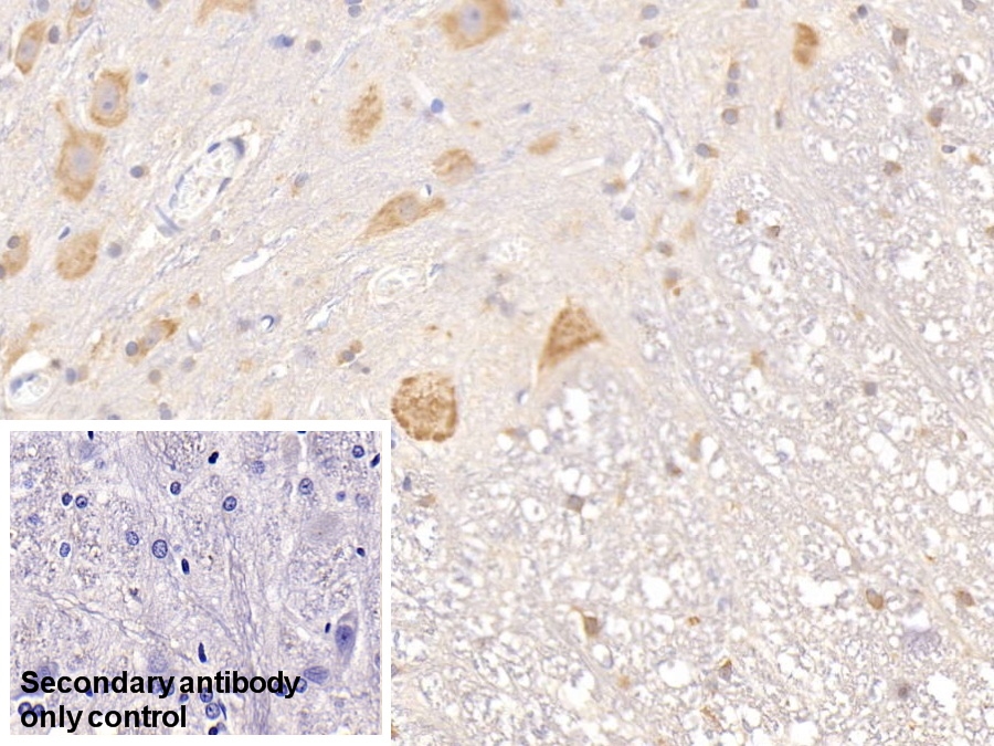 Monoclonal Antibody to Tissue Factor Pathway Inhibitor (TFPI)