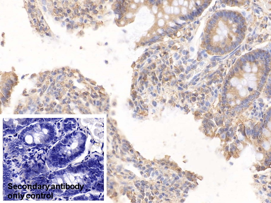 Monoclonal Antibody to Tissue Factor Pathway Inhibitor (TFPI)