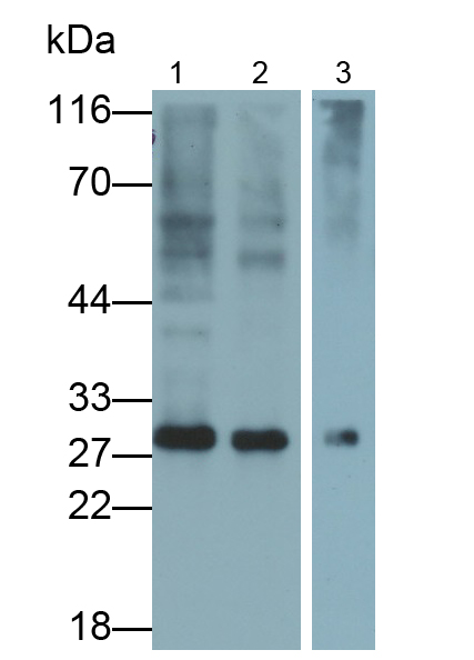 Monoclonal Antibody to Tissue Factor Pathway Inhibitor (TFPI)