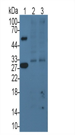 Monoclonal Antibody to Tissue Factor Pathway Inhibitor (TFPI)