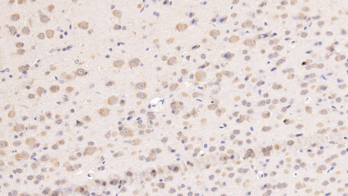 Monoclonal Antibody to Tissue Factor Pathway Inhibitor (TFPI)