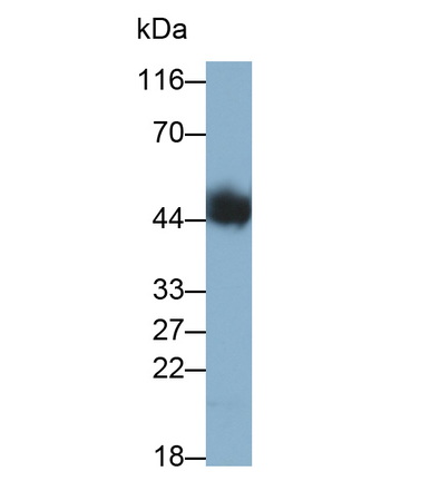 Monoclonal Antibody to Tissue Factor Pathway Inhibitor (TFPI)