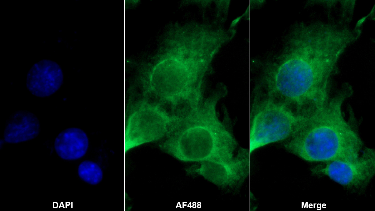 Monoclonal Antibody to Tissue Factor Pathway Inhibitor (TFPI)