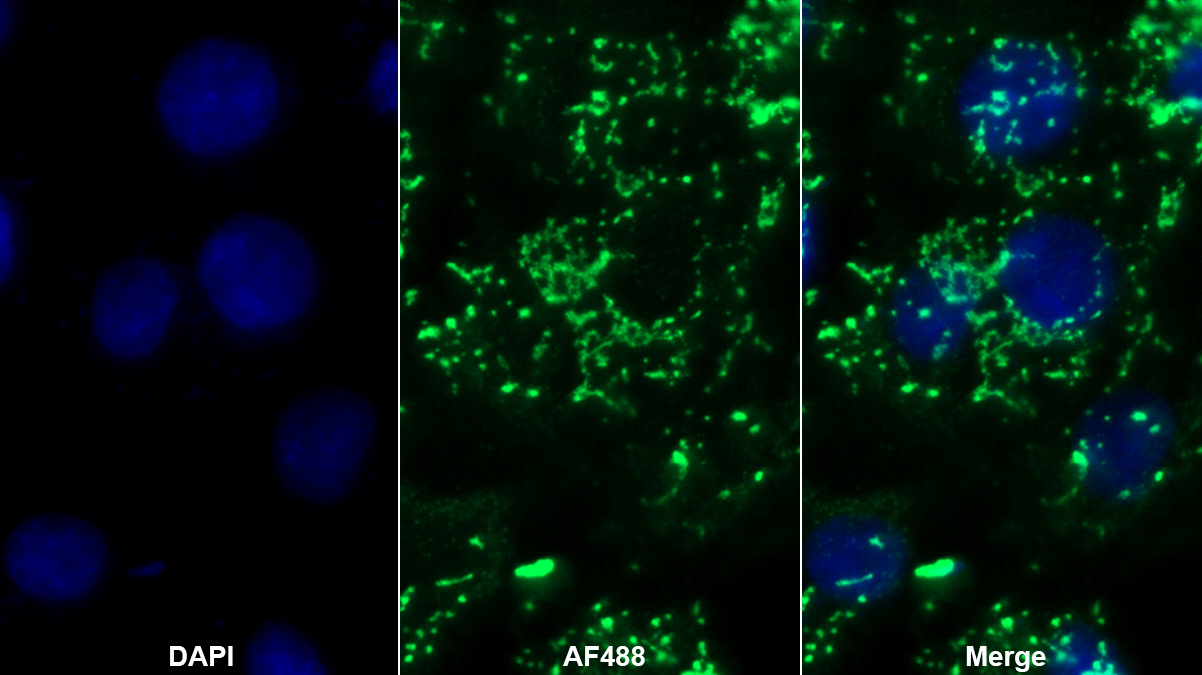 Monoclonal Antibody to Inhibin Alpha (INHa)