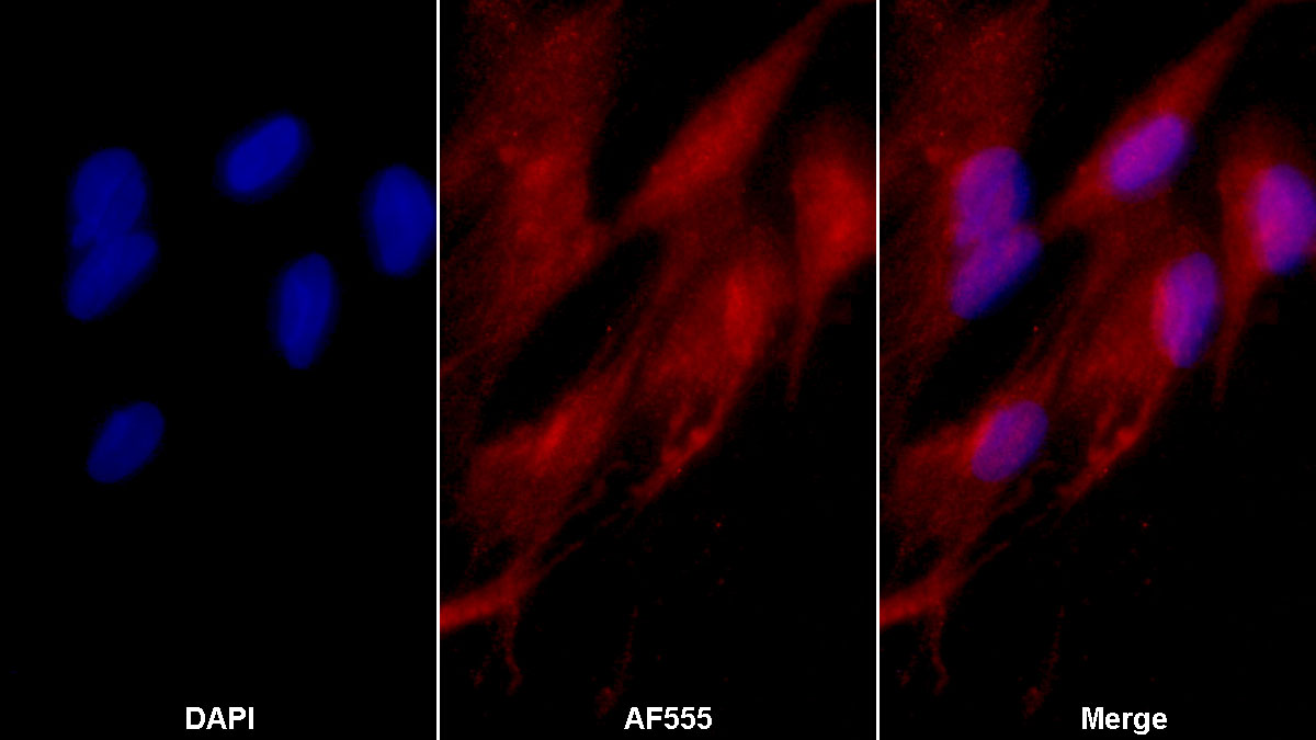 Monoclonal Antibody to Sex Hormone Binding Globulin (SHBG)