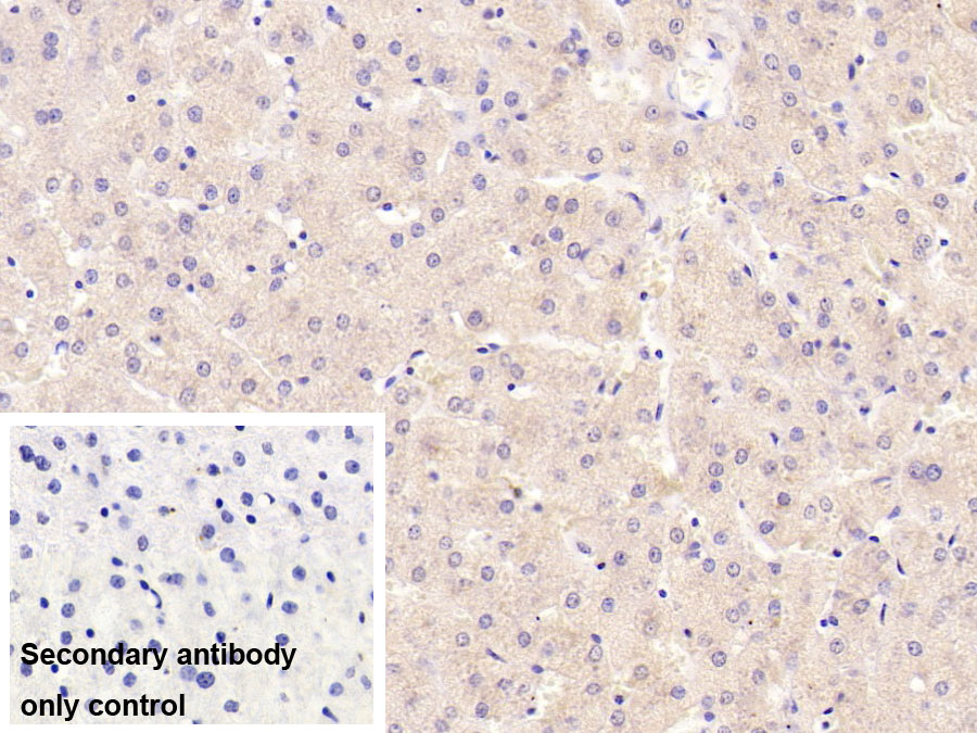 Monoclonal Antibody to Sex Hormone Binding Globulin (SHBG)