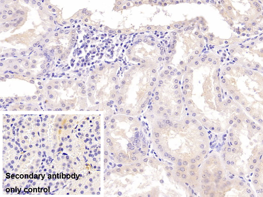 Monoclonal Antibody to Sex Hormone Binding Globulin (SHBG)