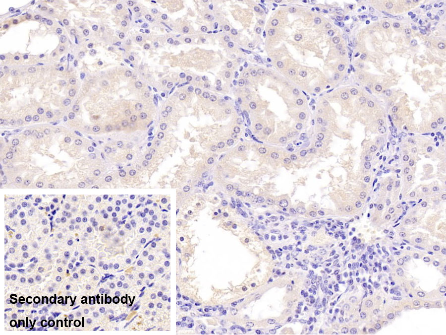 Monoclonal Antibody to Sex Hormone Binding Globulin (SHBG)