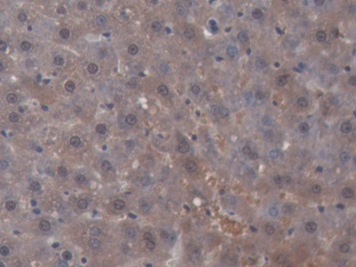 Monoclonal Antibody to Sex Hormone Binding Globulin (SHBG)