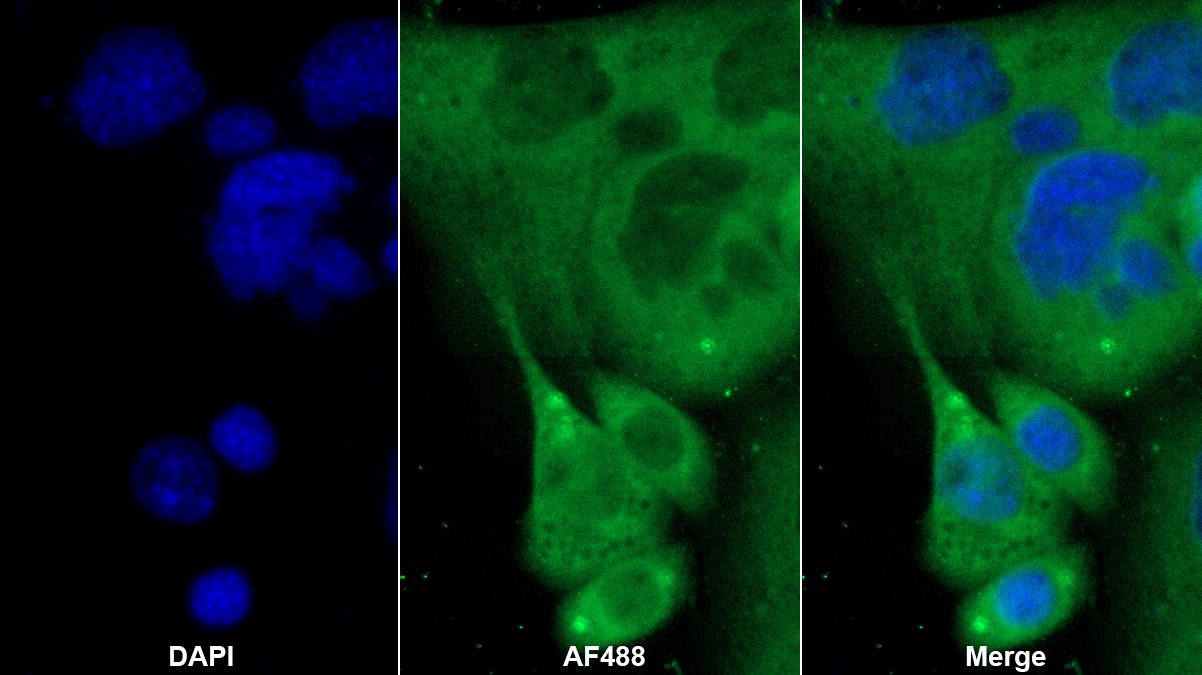Monoclonal Antibody to Sex Hormone Binding Globulin (SHBG)