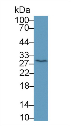 Monoclonal Antibody to High Mobility Group Protein 1 (HMGB1)