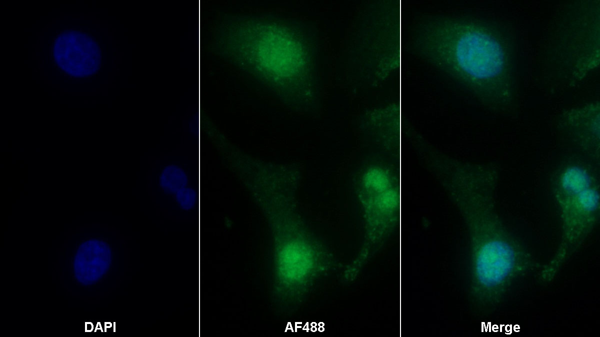 Monoclonal Antibody to High Mobility Group Protein 1 (HMGB1)