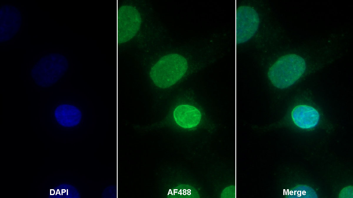 Monoclonal Antibody to High Mobility Group Protein 1 (HMGB1)