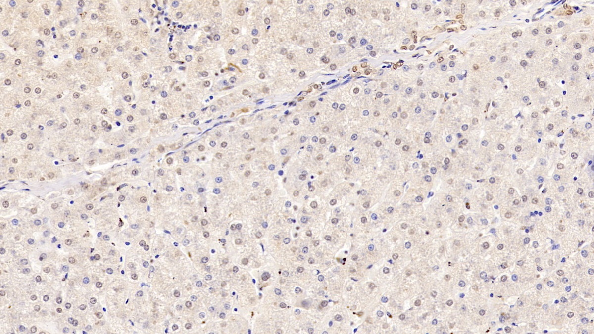 Monoclonal Antibody to High Mobility Group Protein 1 (HMGB1)