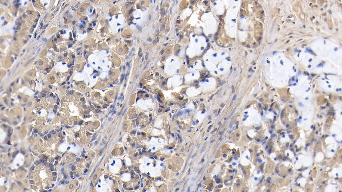 Monoclonal Antibody to High Mobility Group Protein 1 (HMGB1)