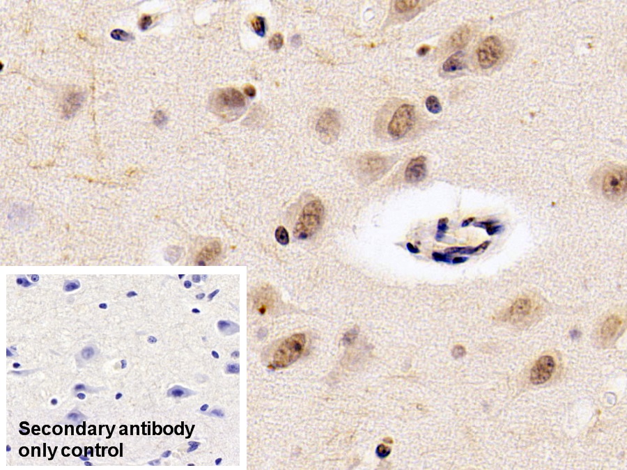 Monoclonal Antibody to Neurogranin (NRGN)