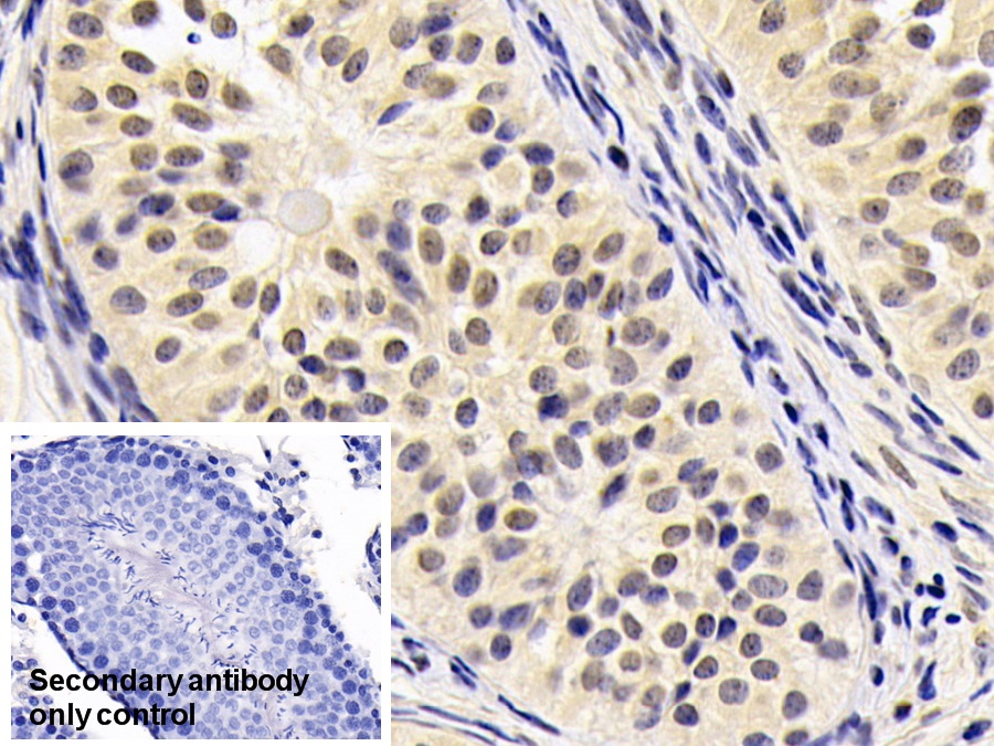 Monoclonal Antibody to Neurogranin (NRGN)