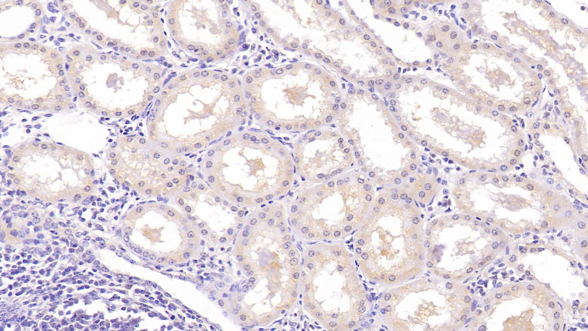 Monoclonal Antibody to Neurogranin (NRGN)