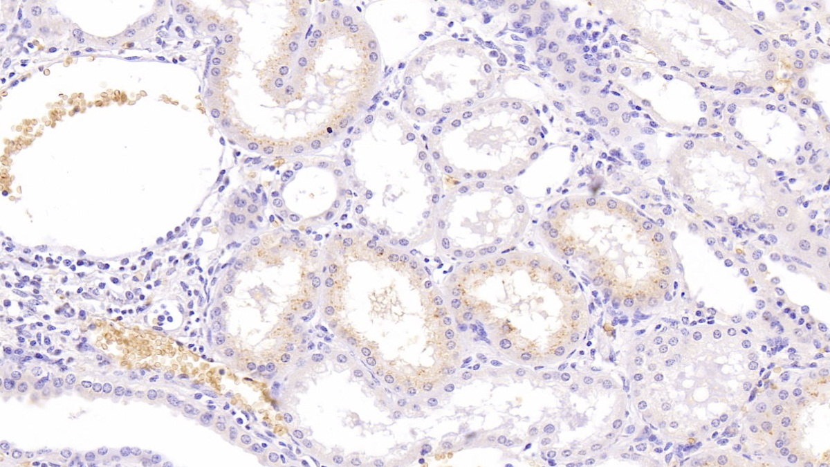 Monoclonal Antibody to Neurogranin (NRGN)