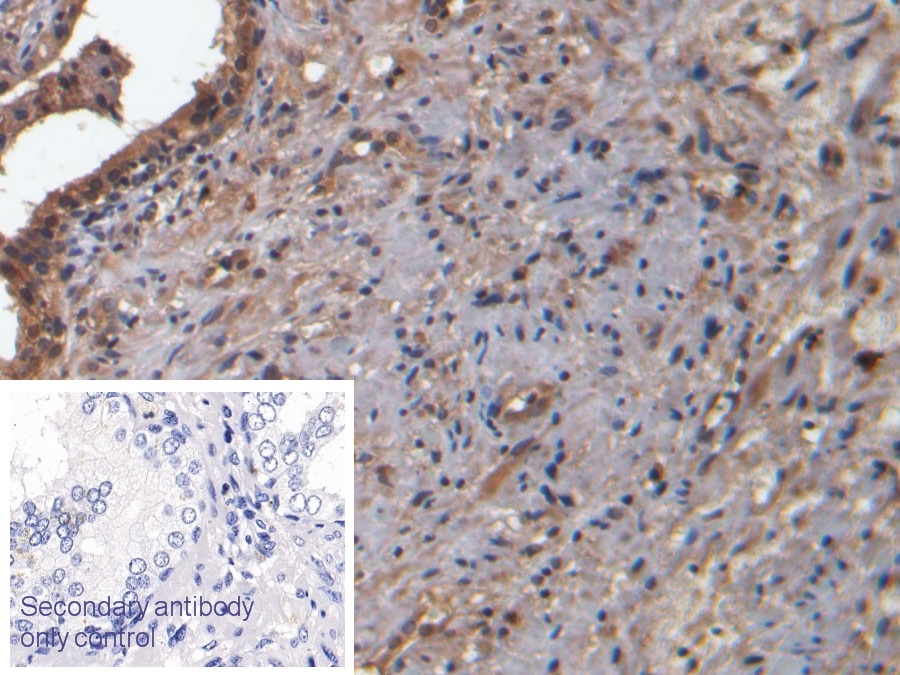 Monoclonal Antibody to Neurokinin A (NKA)