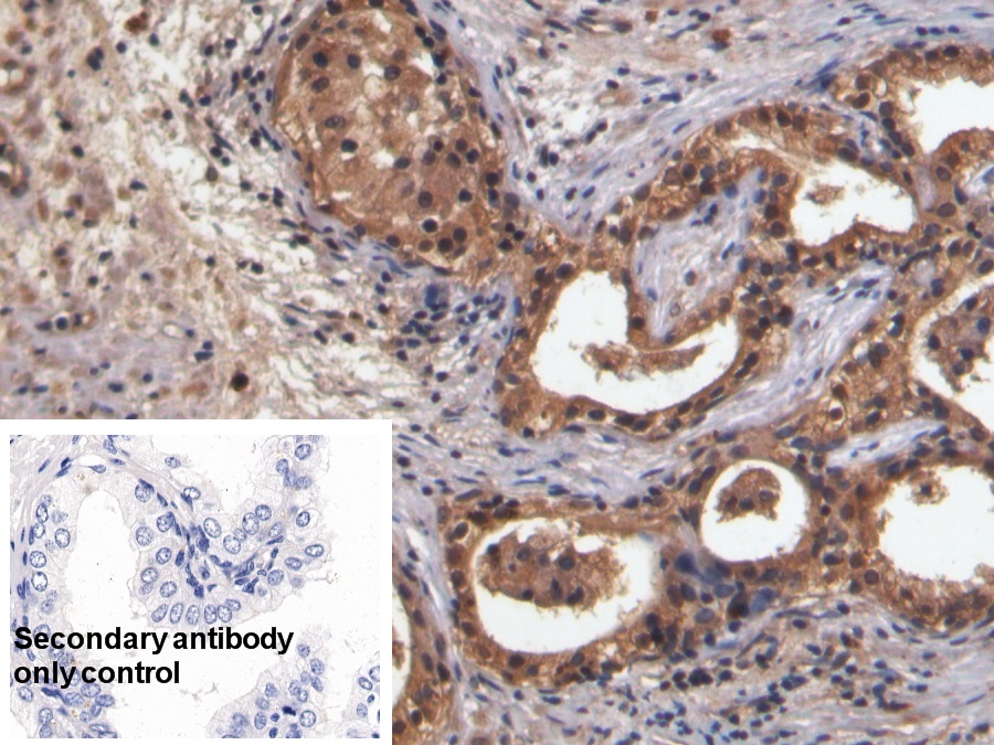 Monoclonal Antibody to Neurokinin A (NKA)