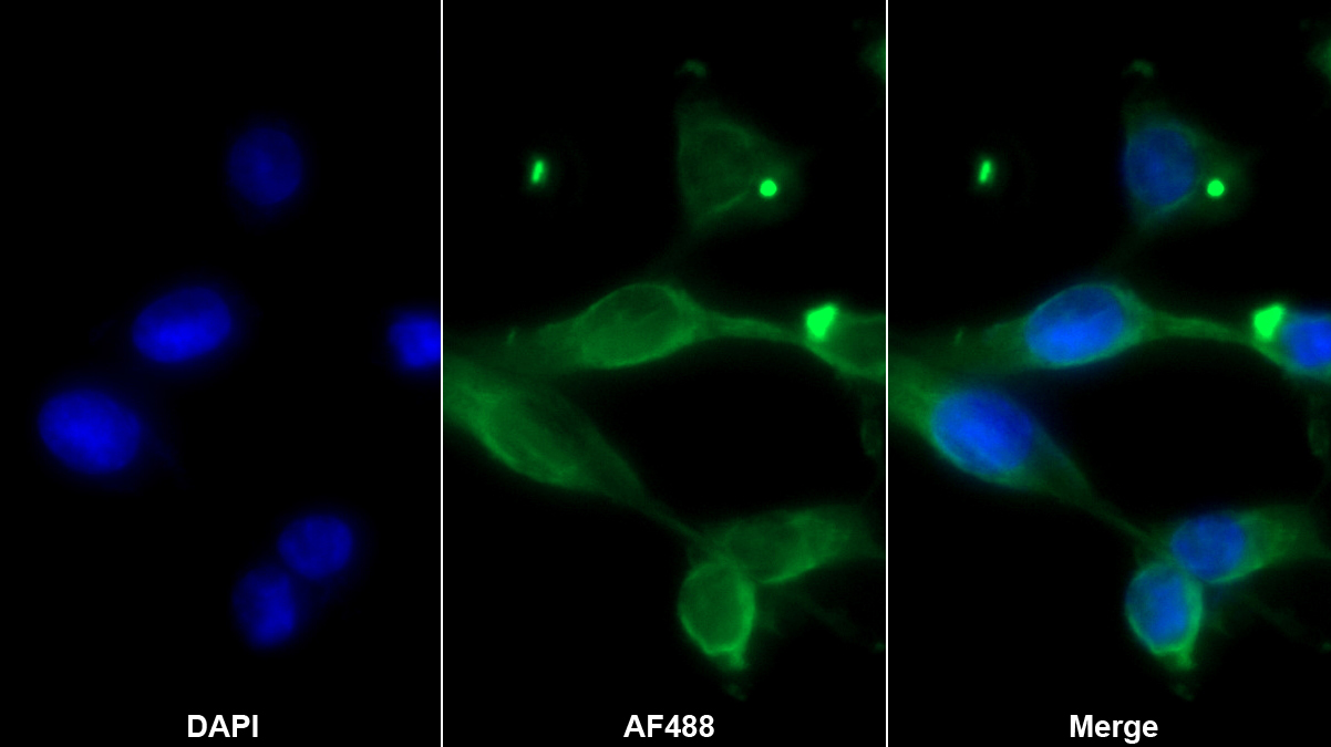 Monoclonal Antibody to Neurokinin A (NKA)